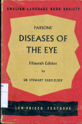 Parson's disease of the eye