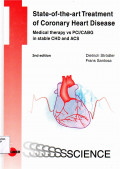 State-of-the-art treatment of coronary heart disease