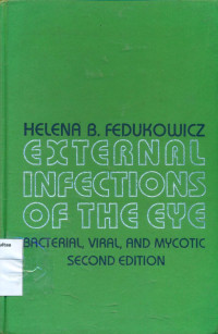 External infections of the eye: bacterial, viral, and mycotic