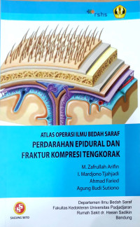 Atlas Operasi Ilmu Bedah Saraf Perdarahan Epidural Dan Fraktur Kompresi Tengkorak